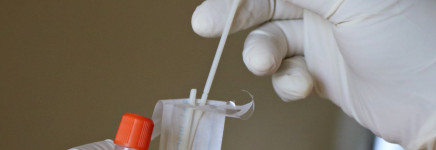 Testbeleid COVID-19 operatieve patiënt