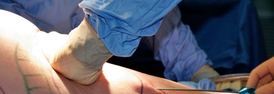 Tweede Kamer neemt wijziging Wet Kwaliteit, Klachten & Geschillen Zorg aan