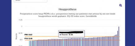 SKI tool voor benchmarken klinieken vanaf 14 juni live